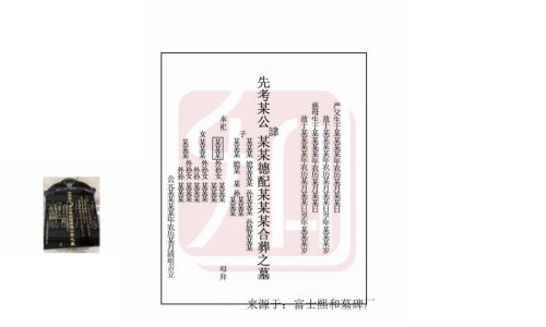 蛋白尿的症状有哪些-蛋白尿病人的症状网 | 蛋白尿的症状图片,蛋白尿病人饮食上注意什么